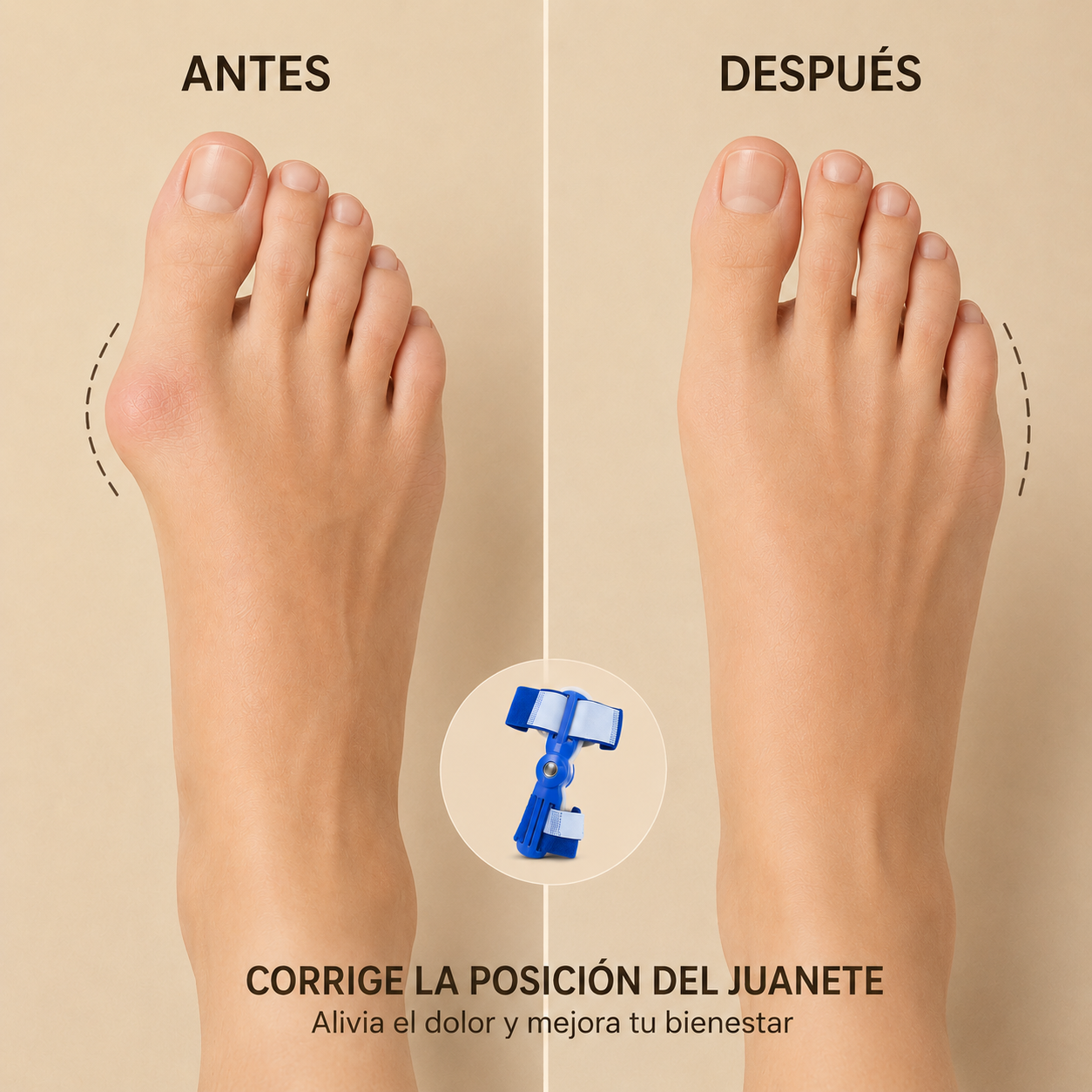 Corrector de juanetes