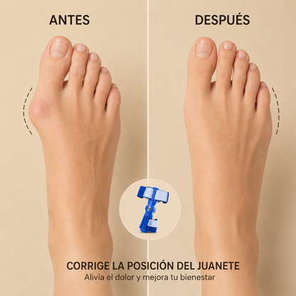 Corrector de juanetes